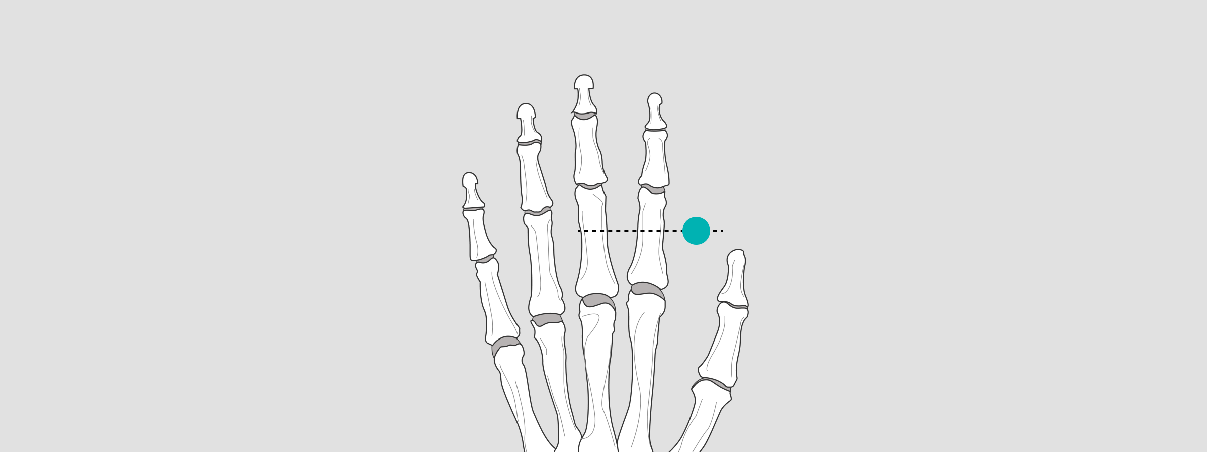 How to do Xray calibration from markers to magnification